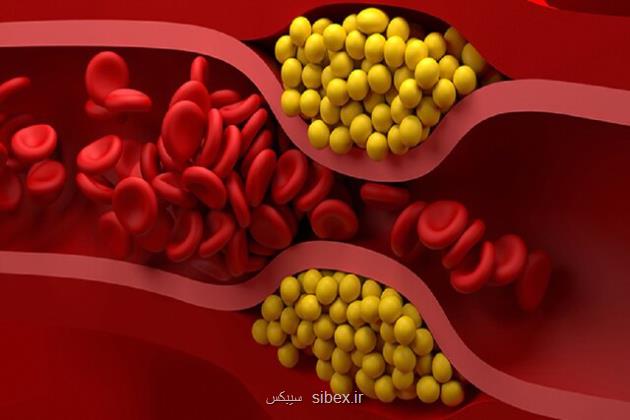 کاهش ۳۰ درصدی کلسترول بد خون با یک واکسن